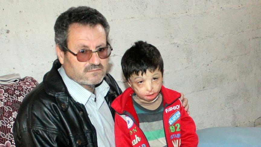 Suriyeli Mahmud’u varil bombası yaktı