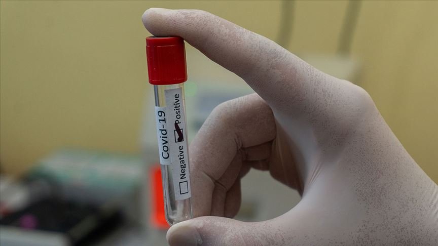 ABD’de Kovid-19’u atlatan 26 genç sporcunun 4’ünde kalp hasarı saptandı