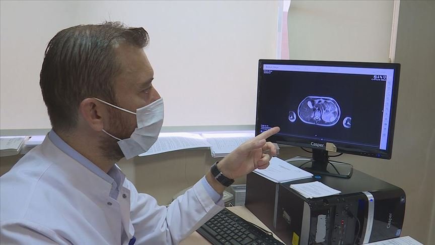 Dalağında kist tespit edilen çocuk riskli bir ameliyat yerine robotik cerrahiyle sağlığına kavuştu
