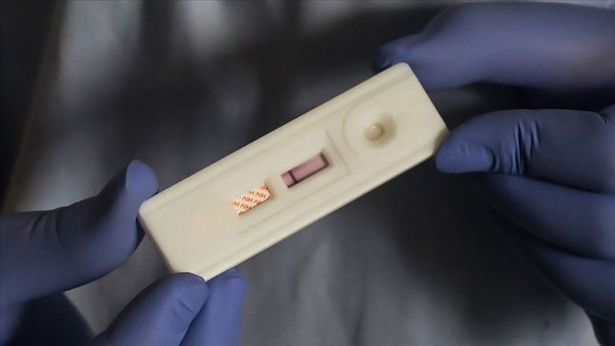 AIDS ile ilişkili hastalıklara bağlı ölüm oranları azaldı