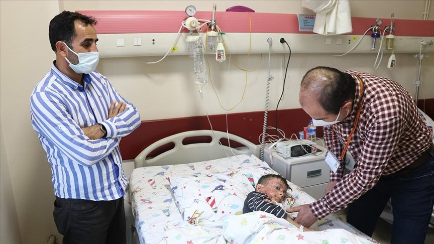 Kütahya’daki üniversite hastanesi kelebek hastalarının umudu oldu