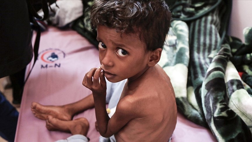 Husiler, ABD’yi Yemen’deki savaşın uzamasının ve insani krizin derinleşmesinin arkasında olmakla suçladı