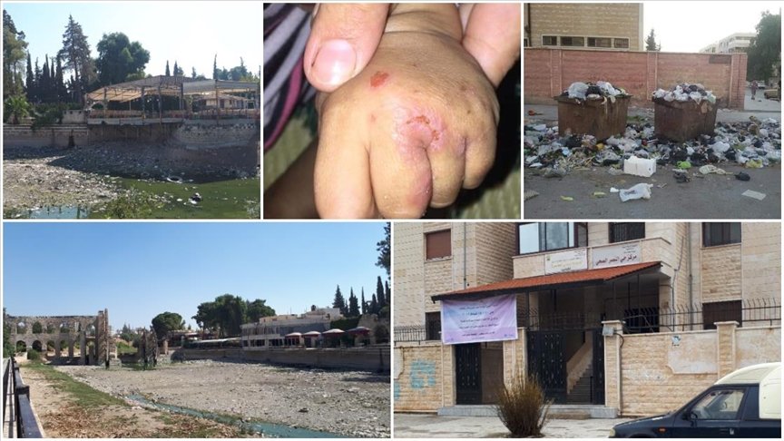 Esed rejiminin kontrolü hiç kaybetmediği Hama’da altyapı sorunları şark çıbanının yayılmasına yol açtı