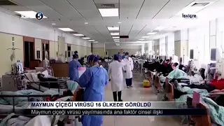 Maymun Çiçeği Virüsü 16 Ülkede Görüldü