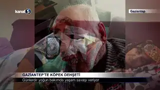 Gaziantep’te Köpek Dehşeti