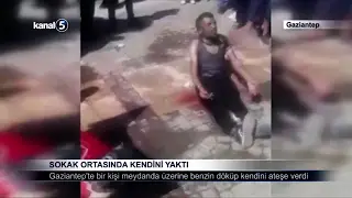 Sokak Ortasında Kendini Yaktı
