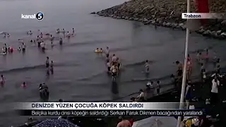 Denizde Yüzen Çocuğa Köpek Saldırdı