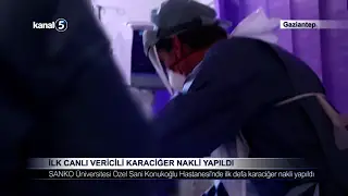 İlk Canlı Vericili Karaciğer Nakli Yapıldı