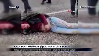 Kaza Yaptı Yüzümde Şişlik Var Mı Diye Sordu