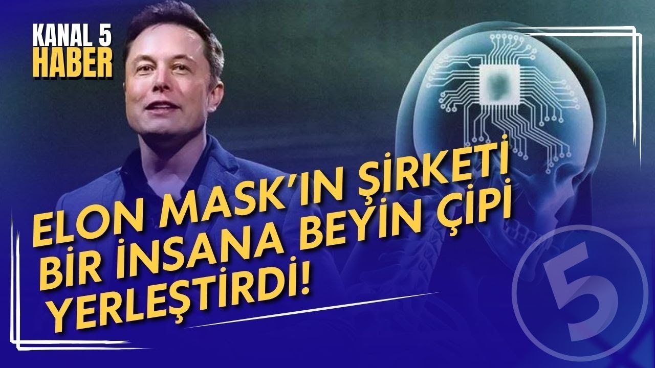 Elon Musk’tan Beyin Çipi Denemesi