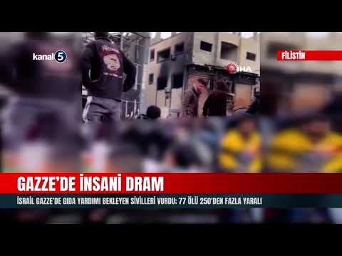 İsrail Gazze’de Gıda Yardımı Bekleyen Sivilleri Vurdu; 77 Ölü 250’den Fazla Yaralı