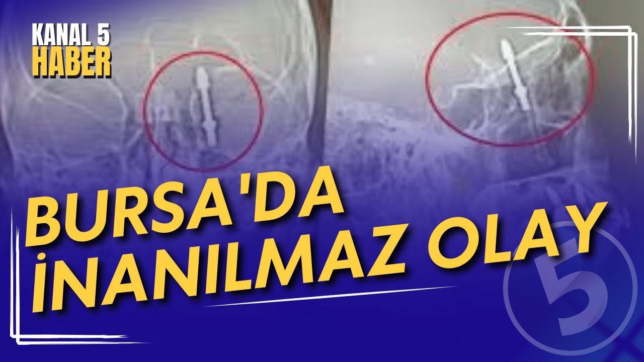 Bursa’da İnanılmaz Olay