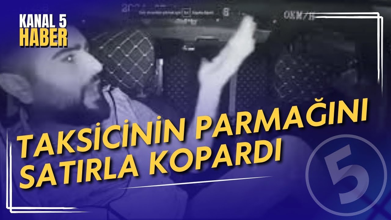 Ankara’da Taksi Şoförüne Satırlı Saldırı | Taksicinin Parmağını Satırla Kopardı
