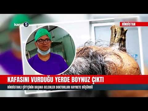 Kafasını Vurduğu Yerde Boynuz Çıktı
