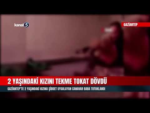 Gaziantep’te 2 Yaşındaki Kızına Şiddet Uygulayan Canavar Baba Tutuklandı